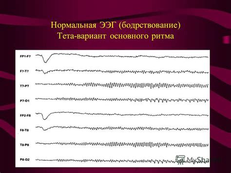 Альтернативные методы лечения основного ритма дезорганизован ЭЭГ