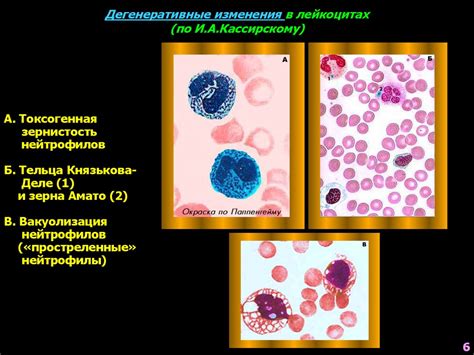 Альтернативные методы лечения умеренно выраженной лейкоцитарной реакции