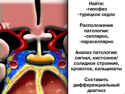 Анатомия селлярной области: структуры, которые исследуются