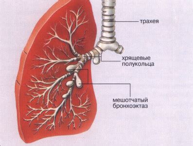 Аномальное расширение легких: что это значит?