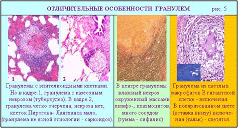 Базовые методы диагностики гранулем