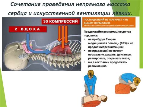 Безопасность при проведении непрямого массажа сердца