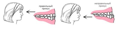 Биологическая значимость отпечатков зубов на языке