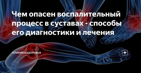 Боли в суставах: виды и способы диагностики