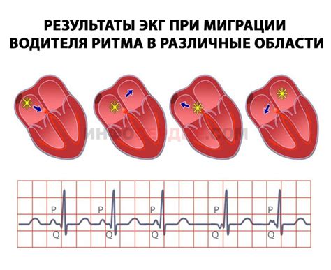 Будущее миграции водителя ритма СЧС