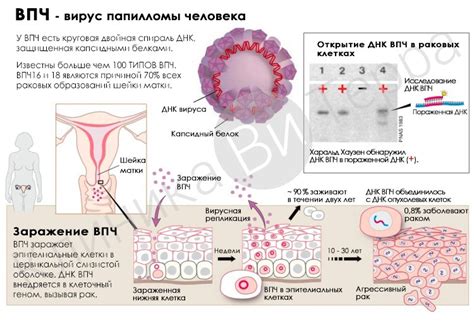 ВПЧ 16 типа у женщин: симптомы, причины и последствия