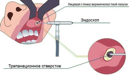 ВЧП на снимке: что это такое?