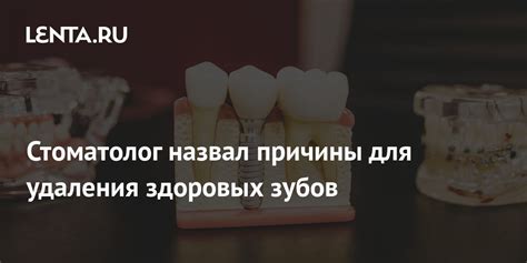 Важность здоровых зубов: причины и решения расхождения