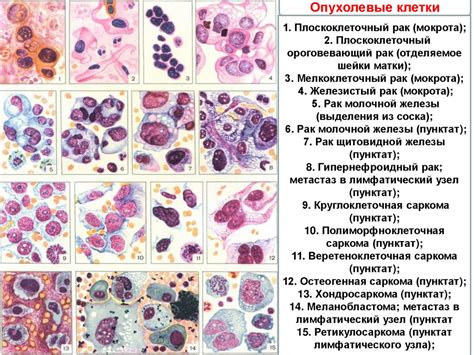 Важность и роль цитологического анализа мазка