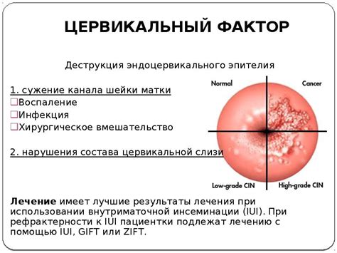 Важность мониторинга эндоцервикального эпителия