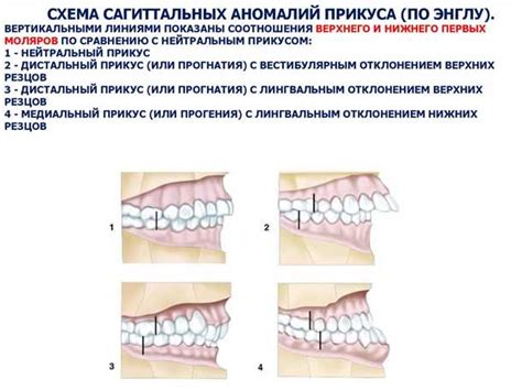 Важность определения нейтрального вкуса