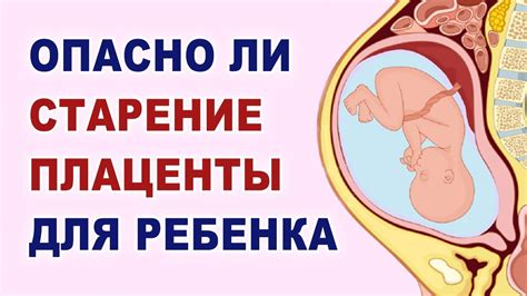 Важность созревания плаценты для здоровья ребенка