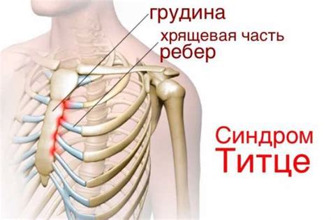 Важность шевеления под ребром с левой стороны