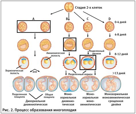 Варианты многоплодной беременности