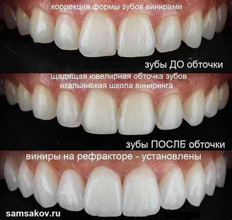 Варианты цветов винира на рефракторе