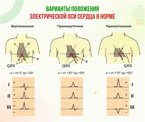 Вертикальное расположение Эос способствует комфорту взрослых