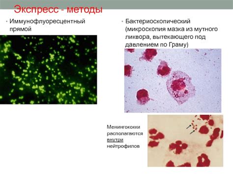 Взаимосвязь мутного ликвора с заболеваниями