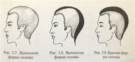 Виды "горячей головы"