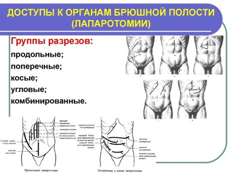 Виды и символика рубца на брюшной полости в видениях