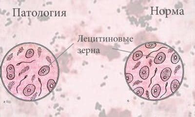 Виды лецитиновых зерен