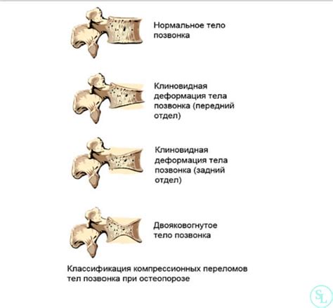 Виды лечения перелома 3 степени