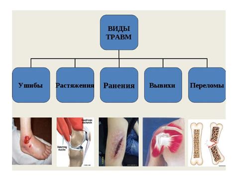 Виды травм