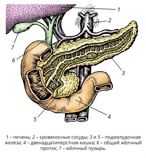 Вирсунгэктазия поджелудочной железы: