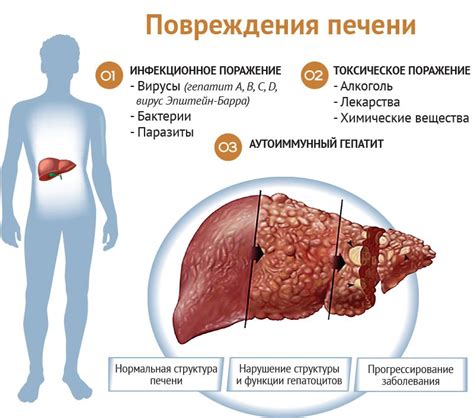 Влияние гепатита C на печень