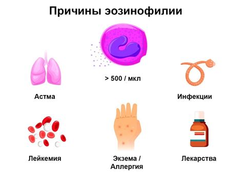 Влияние гормональных нарушений на уровень эозинофилов