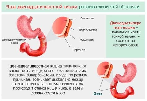 Влияние кофе на работу желудка и пищеварительную систему