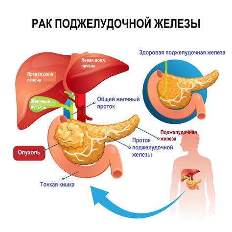 Влияние мелковолнистого контура поджелудочной железы на организм