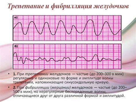 Влияние нарушения сердечного ритма на организм