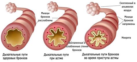 Влияние на развитие астмы