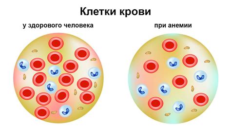 Влияние низкого значения эритроцитов в крови: