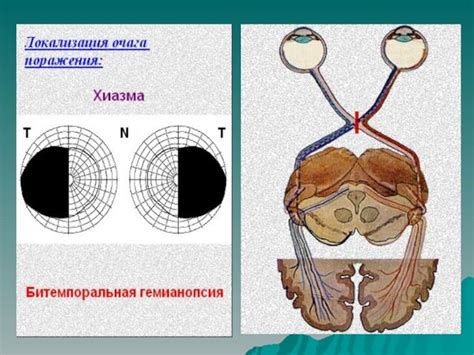 Влияние нистагма на зрительные функции