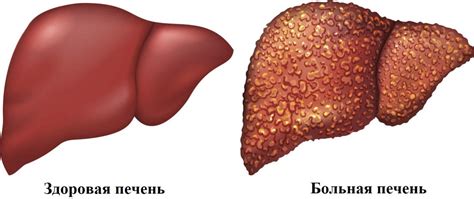 Влияние новообразований на работу печени