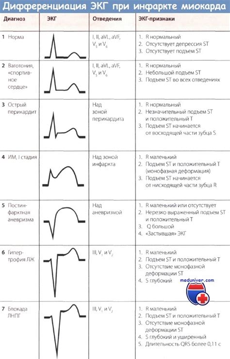 Влияние отсутствия изменений ЭКГ на диагностику