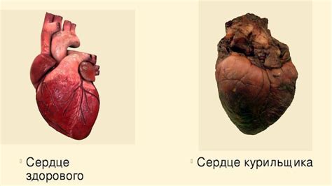 Влияние отсутствия линии сердца на здоровье