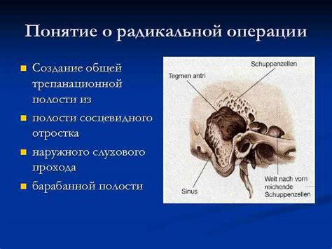 Влияние пневматизации височных костей на качество жизни