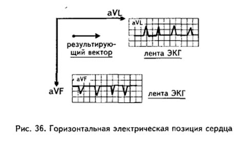 Влияние полувертикальной электрической позиции сердца на здоровье