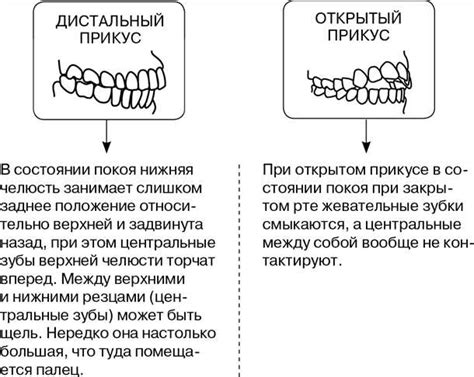 Влияние прикуса языка на речь