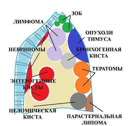 Влияние расширенного средостения на организм