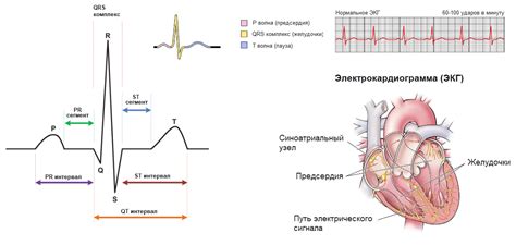 Влияние результатов ЭКГ на диагностику сердечных заболеваний