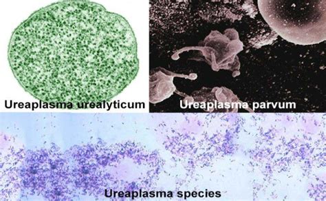 Влияние роста ureaplasma spp на лечение уреаплазмоза