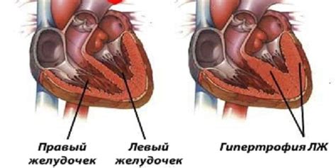 Влияние стресса на работу левого желудочка сердца