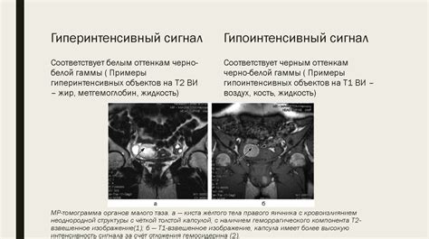 Влияние стромы неоднородной структуры на функционирование органов