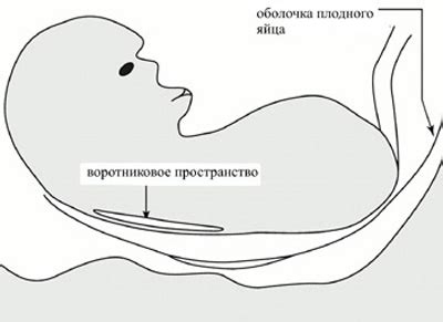 Влияние типа ткани на толщину воротникового пространства