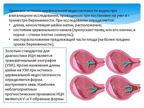 Влияние цервикальной выстилки на плодность