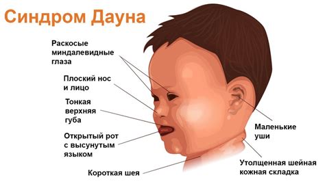 Внешние признаки и особенности оглоедов