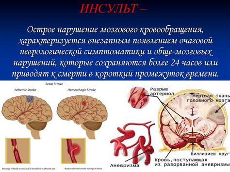 Внутримозговое кровоизлияние: определение и классификация